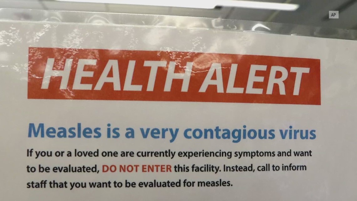 El Dorado County warns of possible measles exposure [Video]