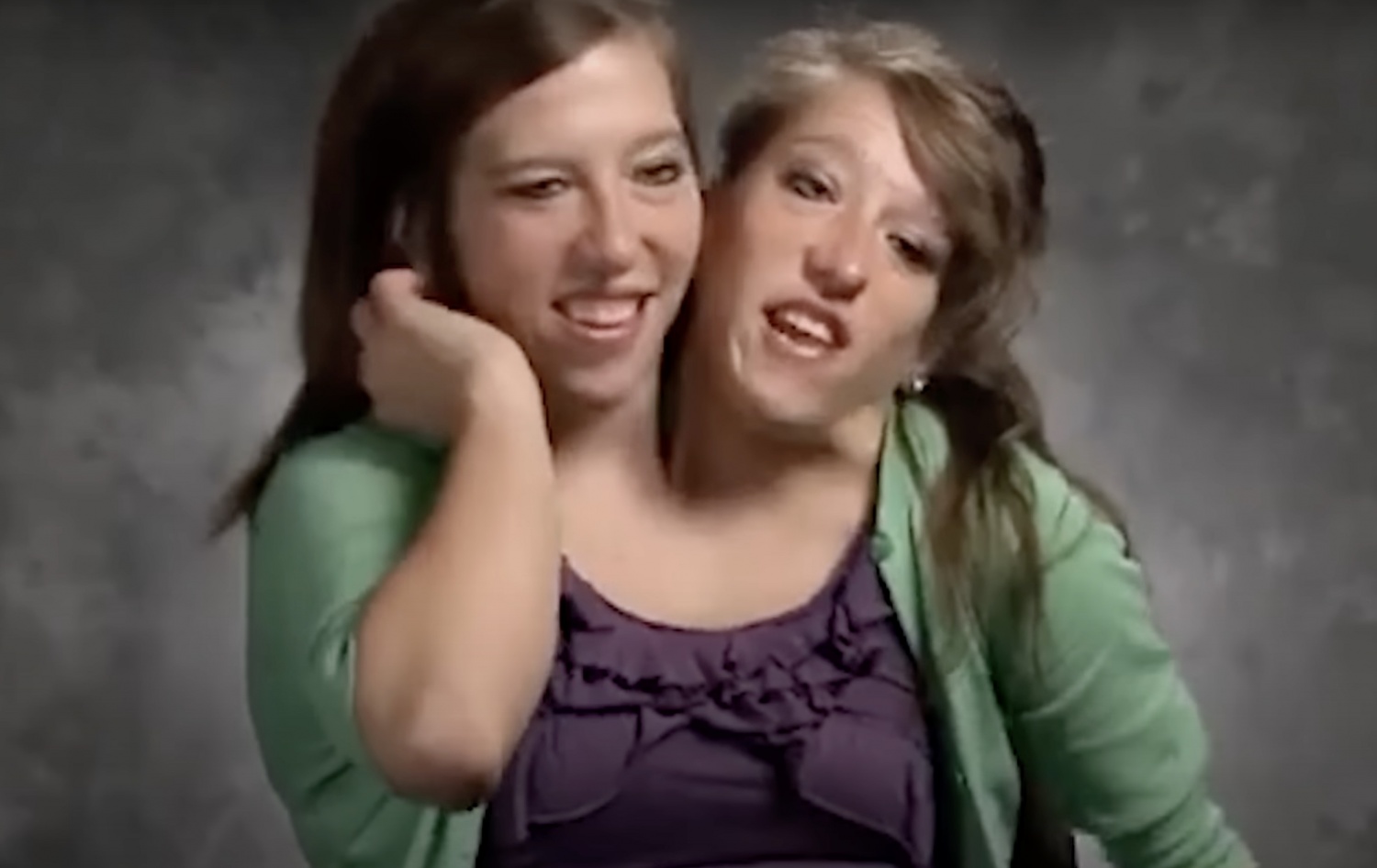 One of Conjoined Twins Abby and Brittany Hensel, Famous from TLC Show, is Now Married and Expanding Family | HNGN [Video]