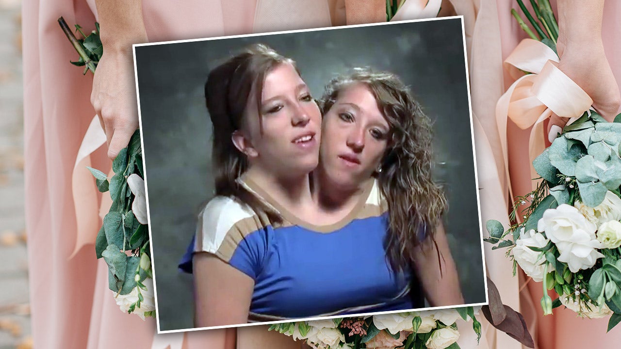 Conjoined twin Abby Hensel, of TLC’s ‘Abby & Brittany,’ is now married, reports say [Video]