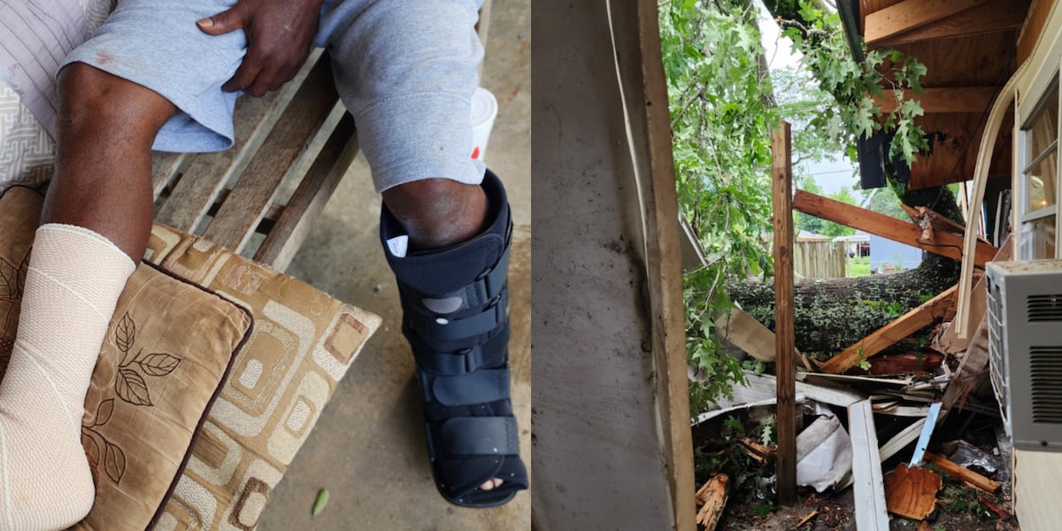 She saved my life: Wife saves husband from under roof after tree falls on house breaking his legs [Video]