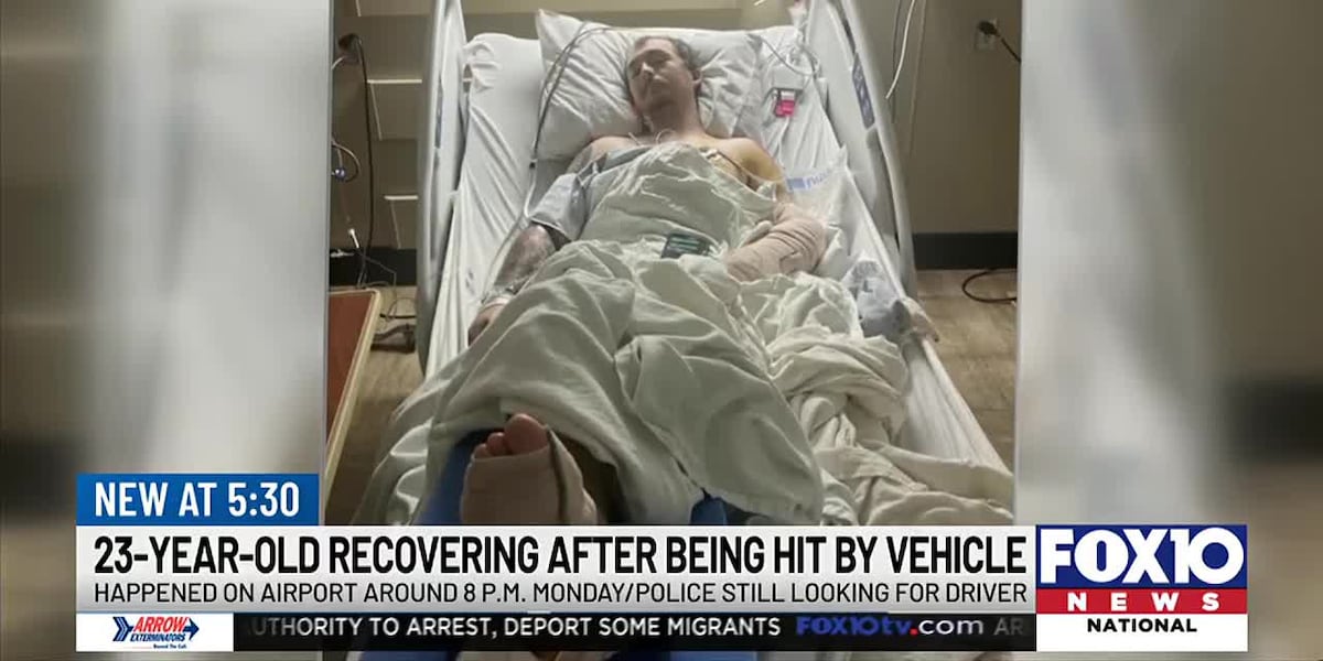 Mobile family begging for answers in hit-and-run that severely injured 23-year-old on Airport Boulevard [Video]