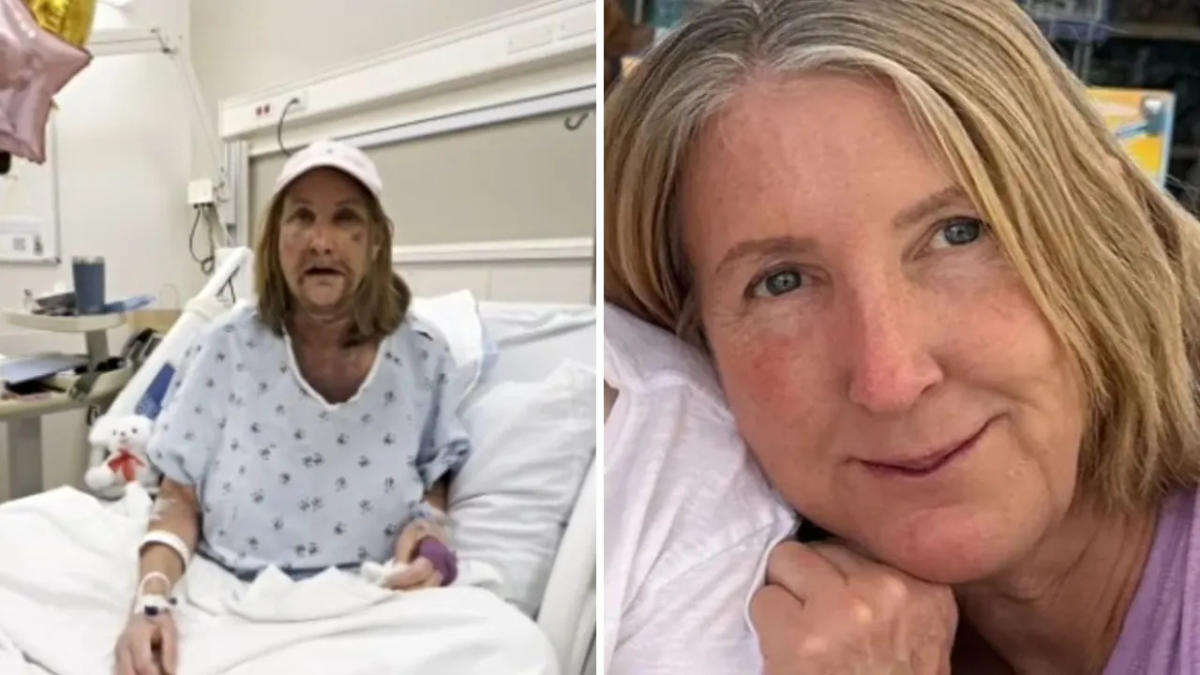 California woman’s mouth wired shut after random attack in ritzy waterfront LA neighborhood [Video]