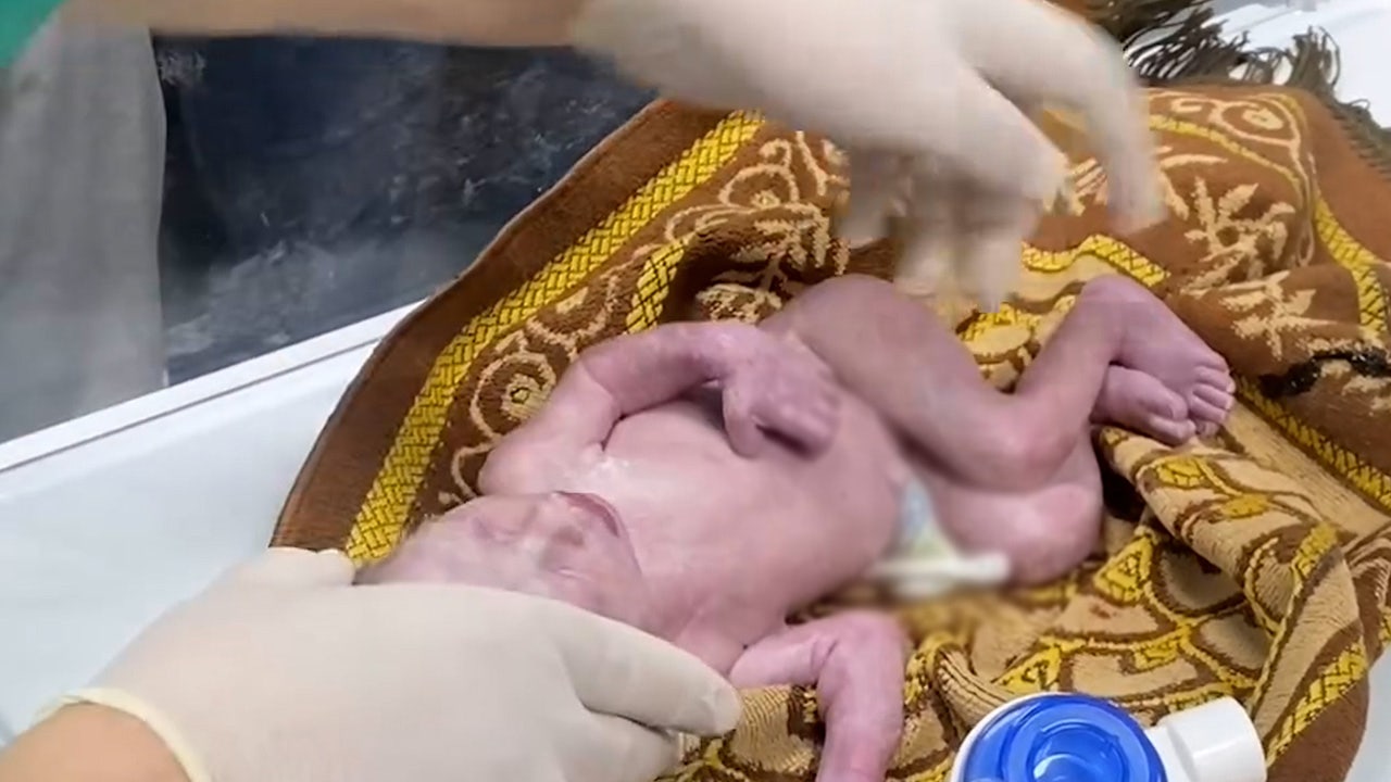 Doctors deliver baby via cesarean section after mother killed in Israeli airstrike [Video]