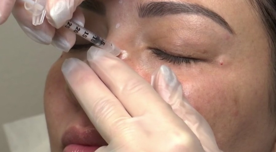 County officials warn about dangers of counterfeit Botox after woman suffers botulism [Video]