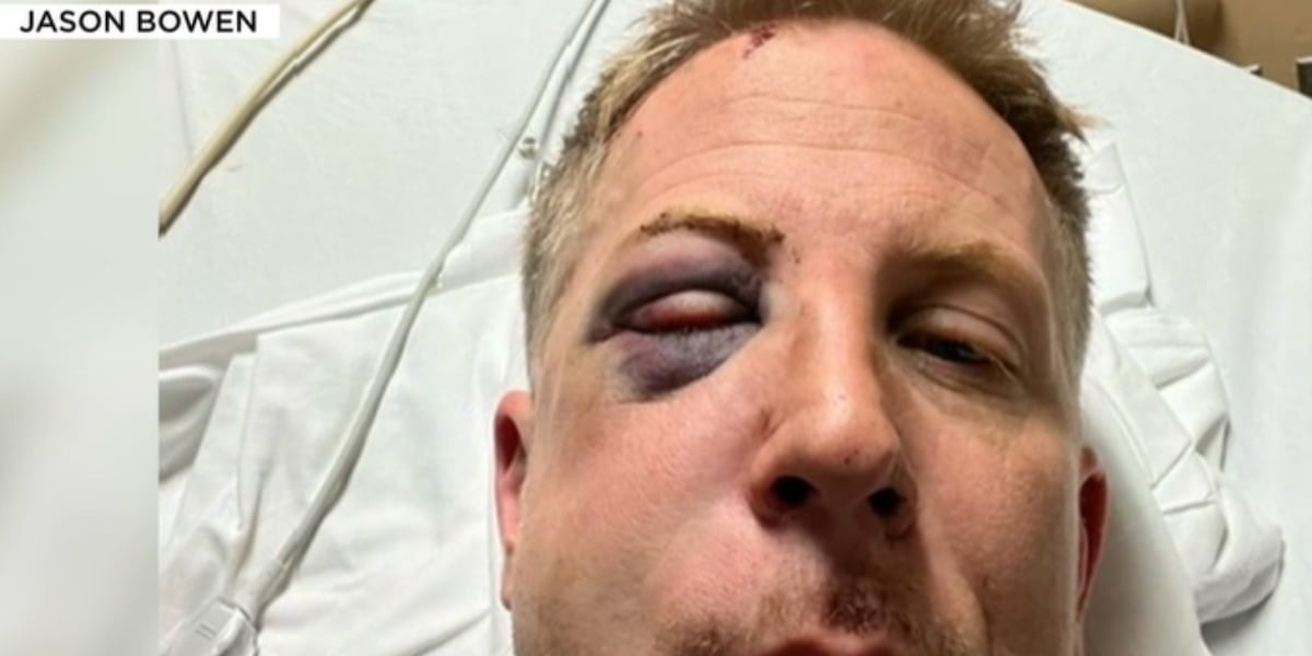 Golden Knights fan searching for man who punched him, sent him to hospital after Dallas game [Video]