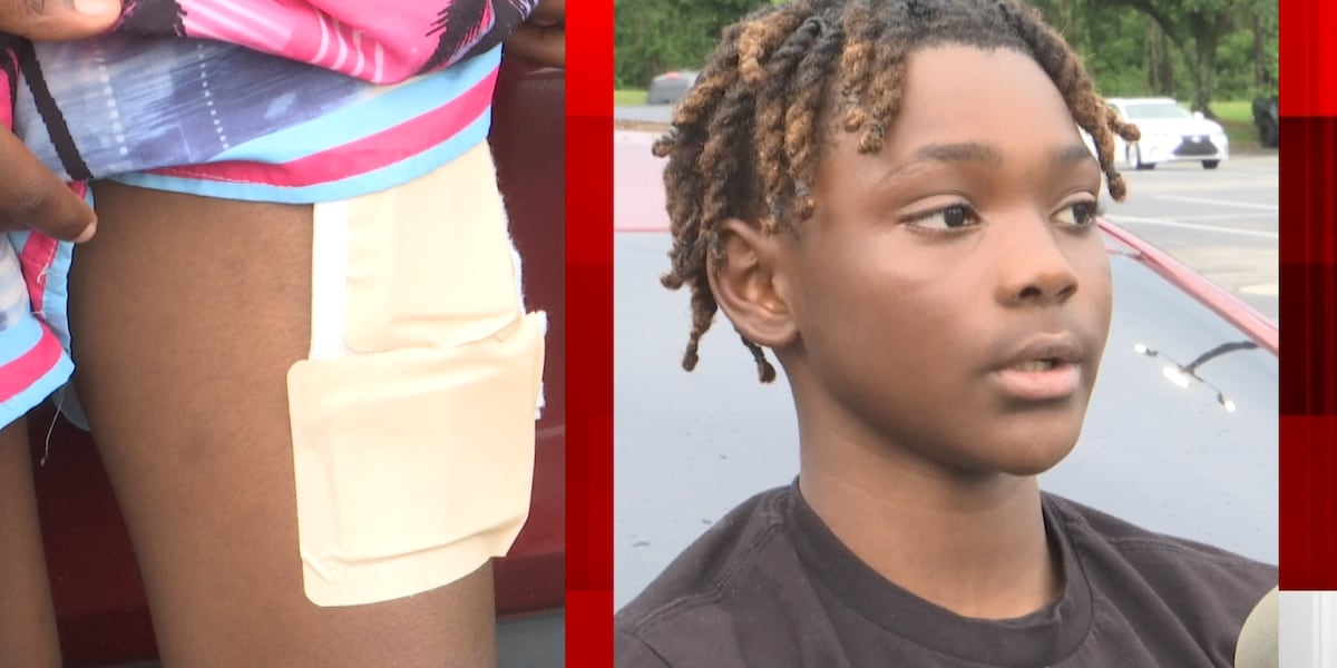 13-year-old May Day shooting victim is speaking out [Video]