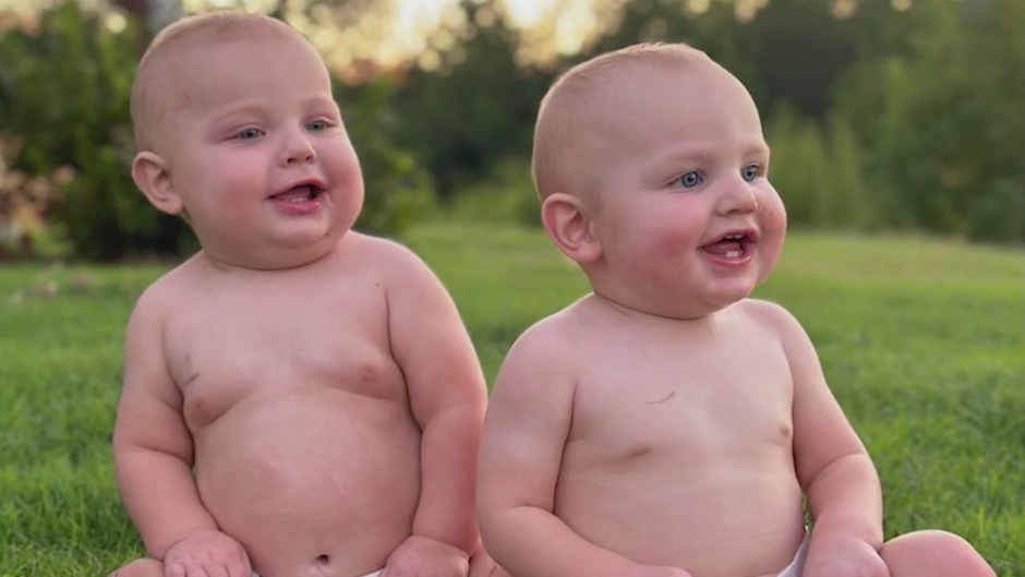 Bump on twin’s face leads to mom’s search for answers [Video]