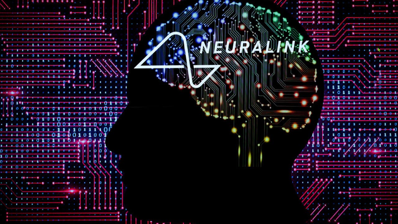 Neuralink knew for years that tiny wires in brain were an issue, Reuters says [Video]