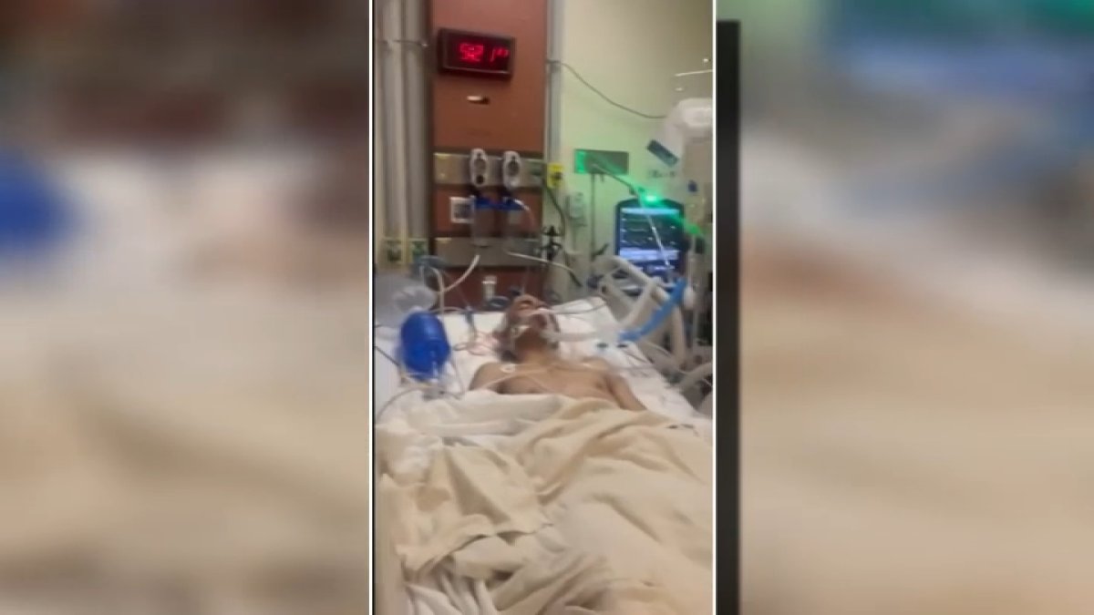 Teen who was attacked in Watts undergoes second surgery  NBC Los Angeles [Video]