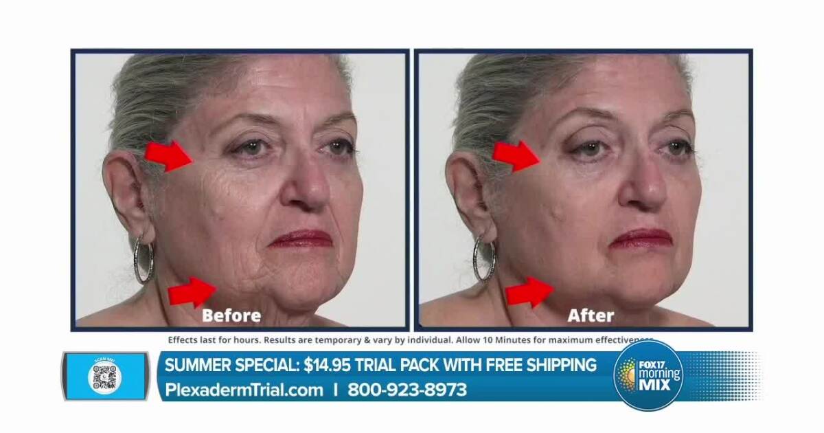 Have your skin look young for summer fun with Plexaderm [Video]