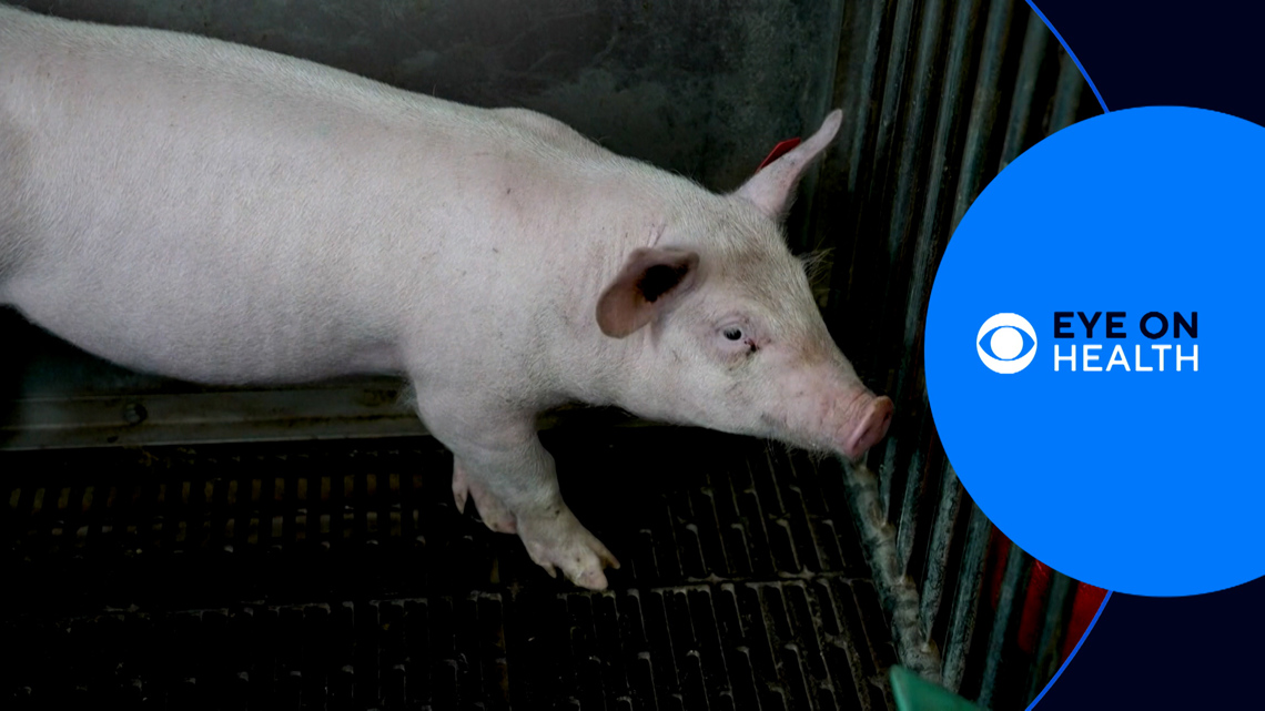 Pigs for transplant & medical chatbots | Eye on Health [Video]